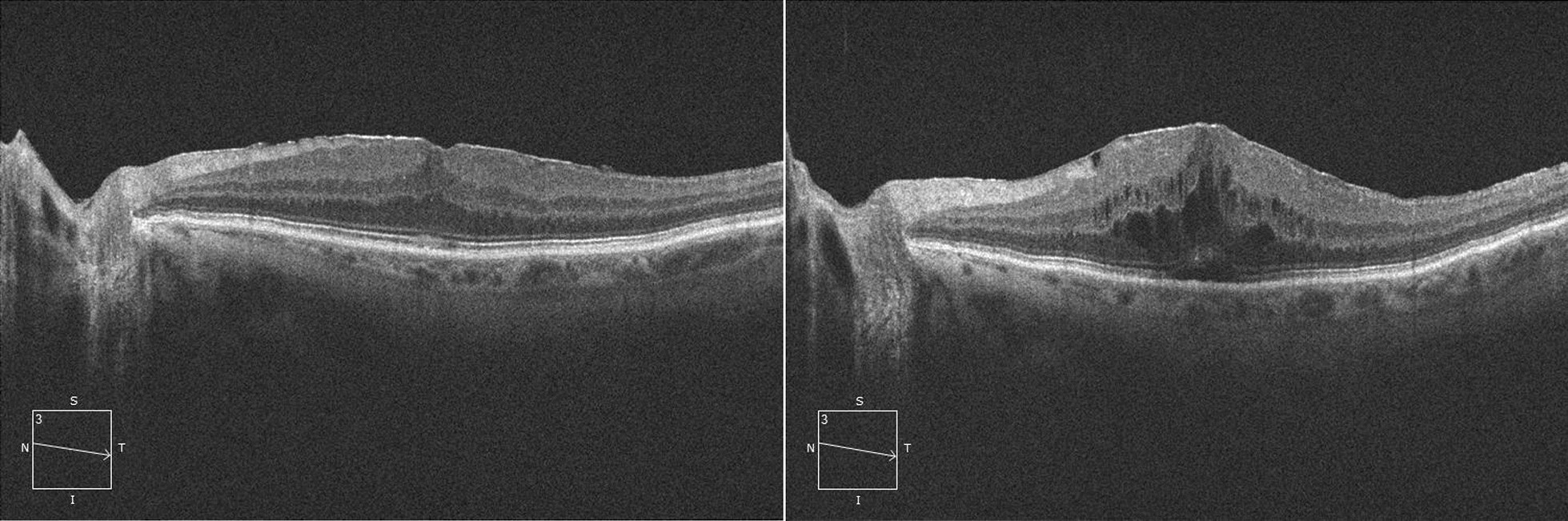 Fig. 2