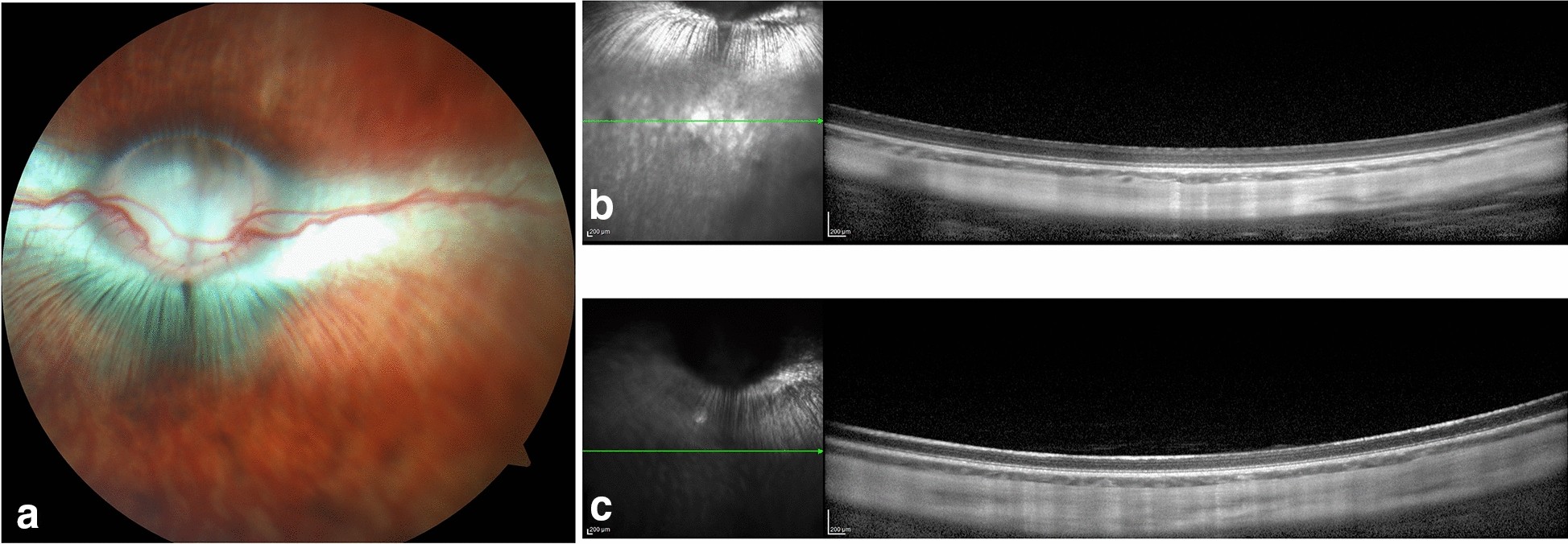 Fig. 4