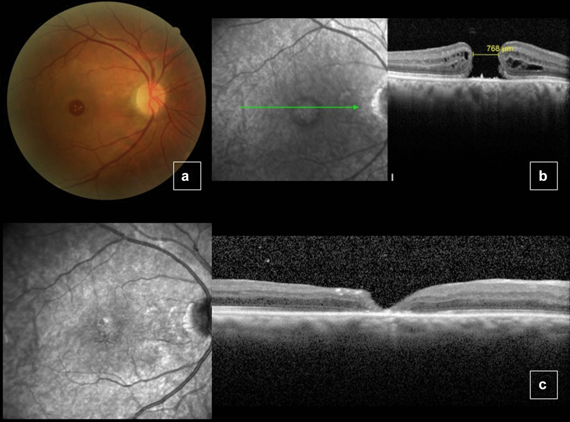 Fig. 4