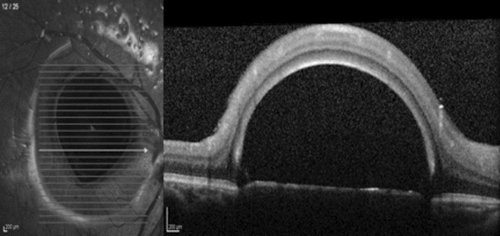 Fig. 4