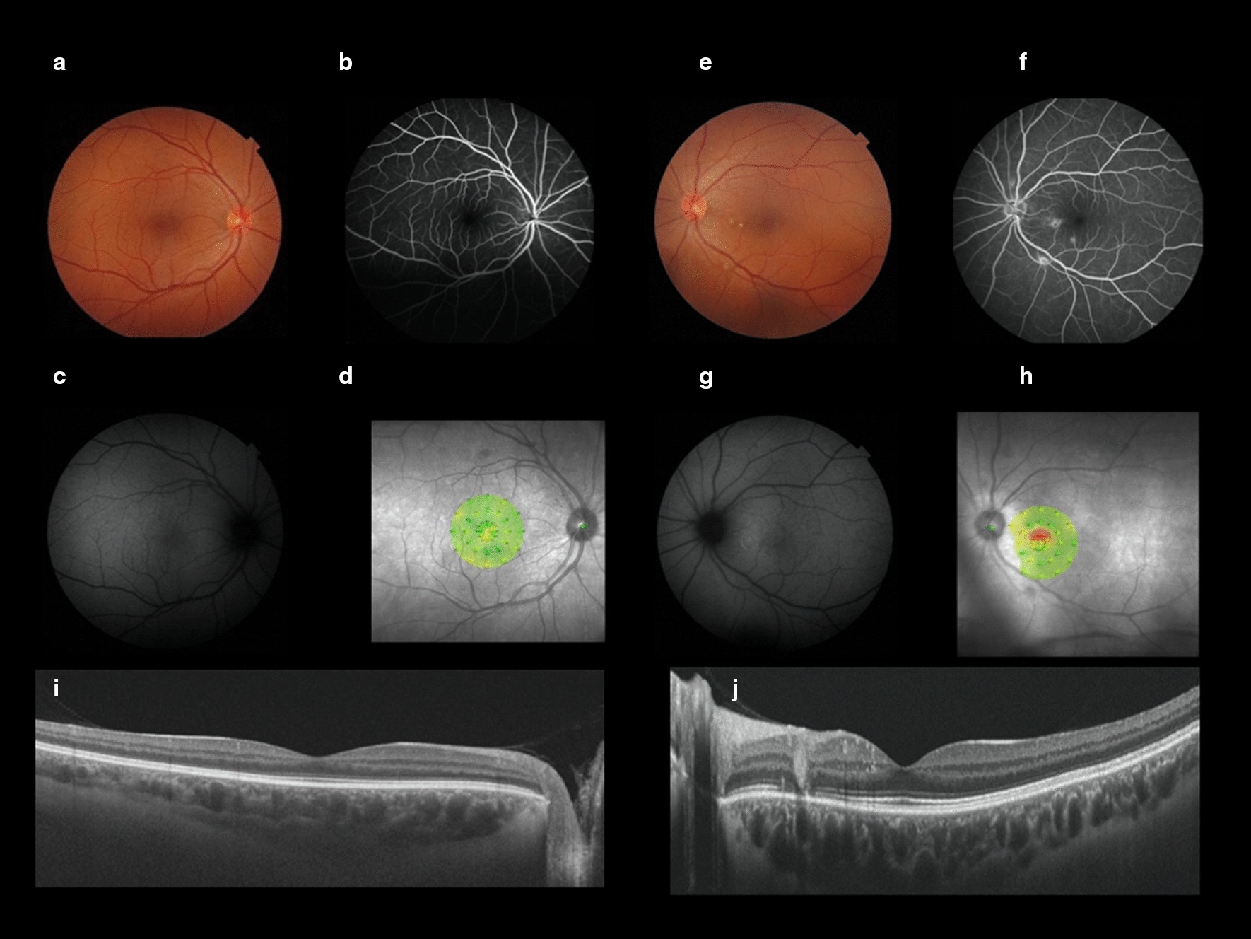 Fig. 1