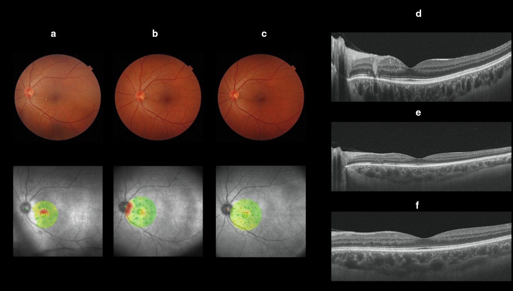 Fig. 2