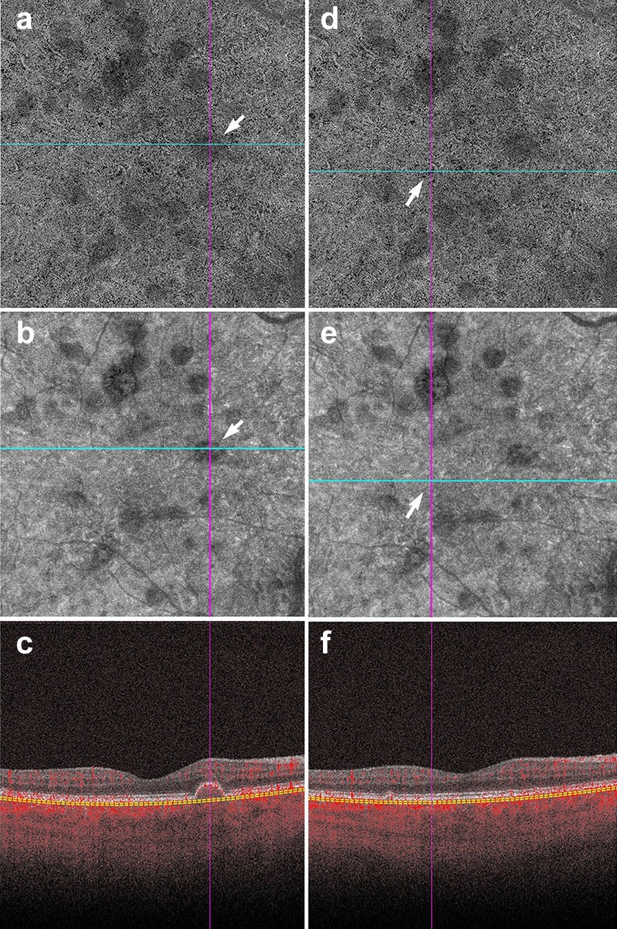 Fig. 4