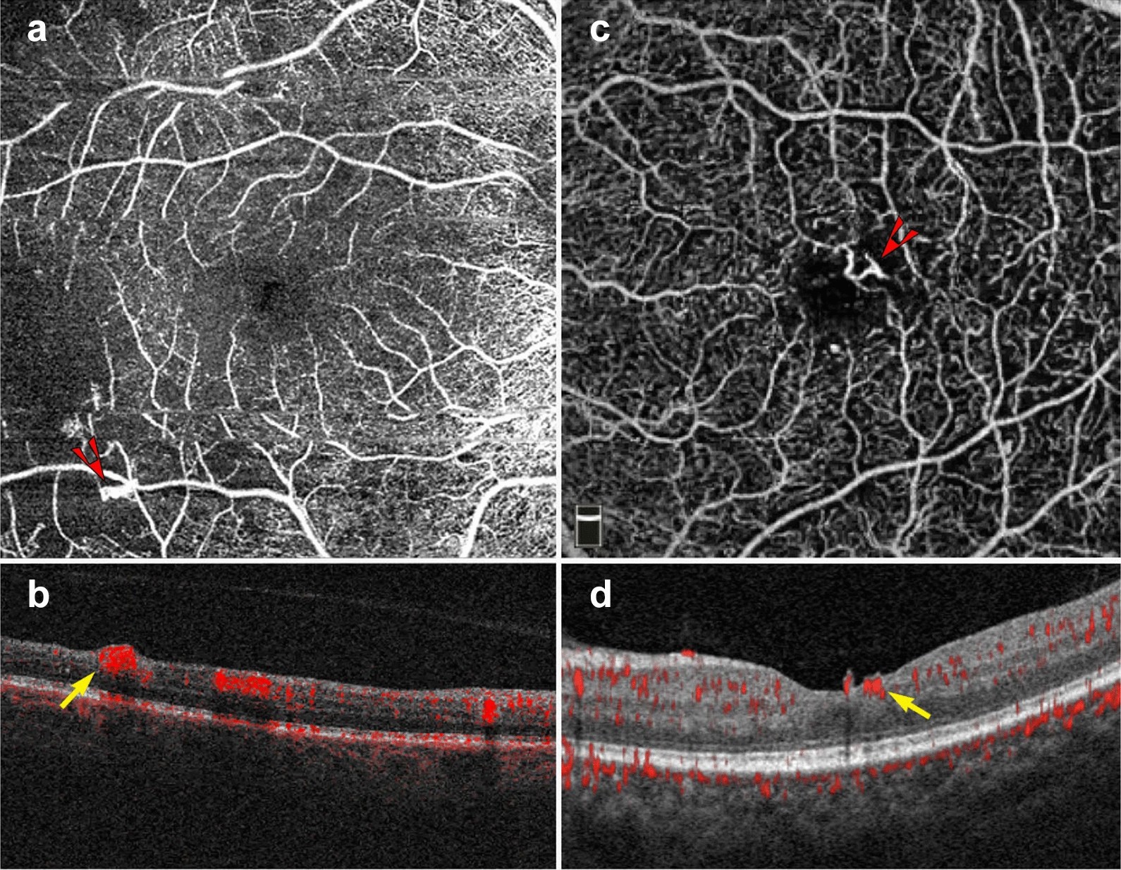 Fig. 8