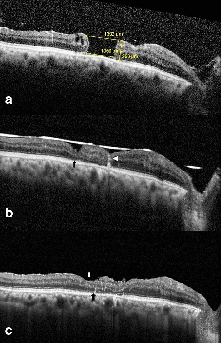 Fig. 4