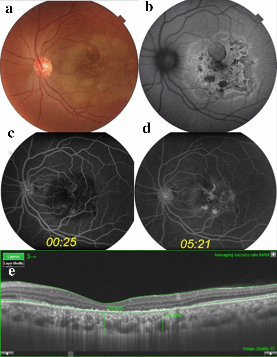 Fig. 1