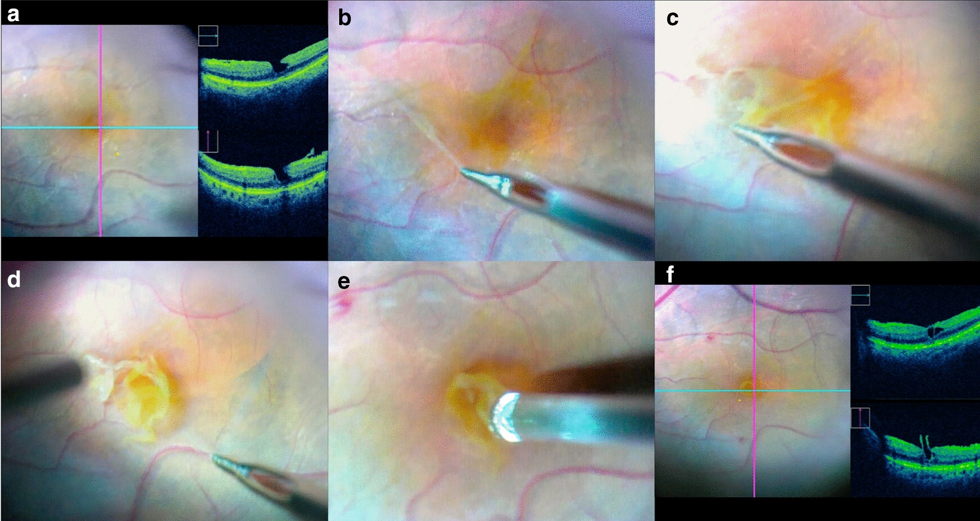 Fig. 1