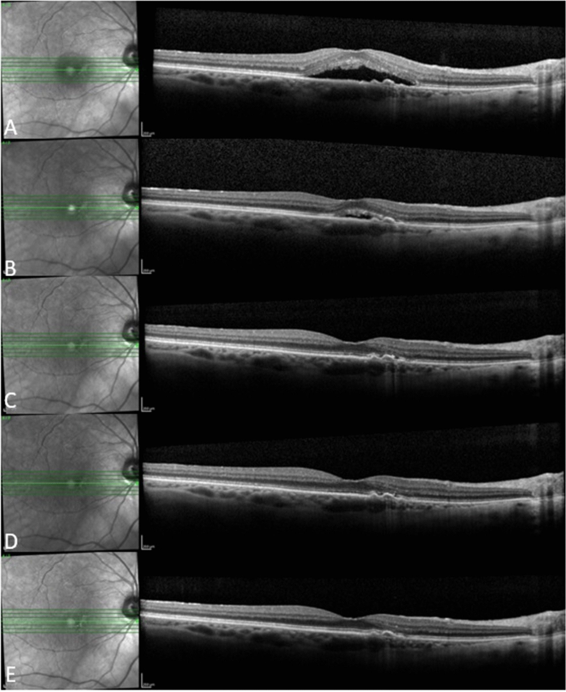 Fig. 3