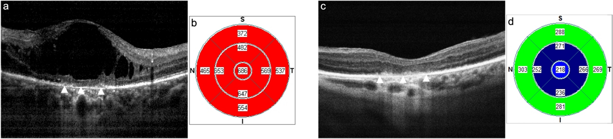 Fig. 4