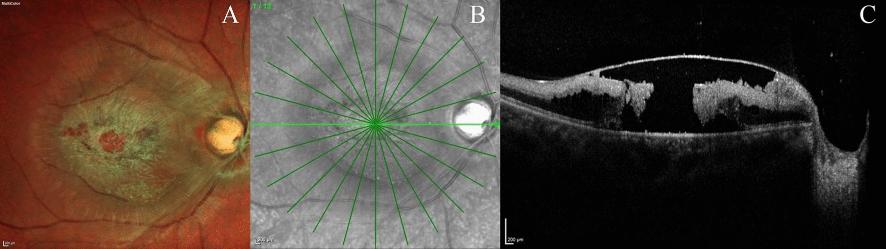 Fig. 2