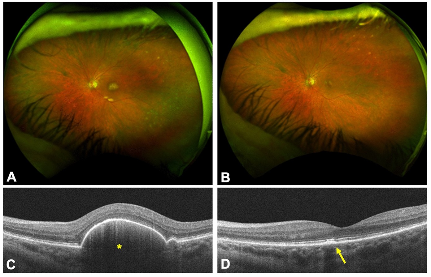 Fig. 2