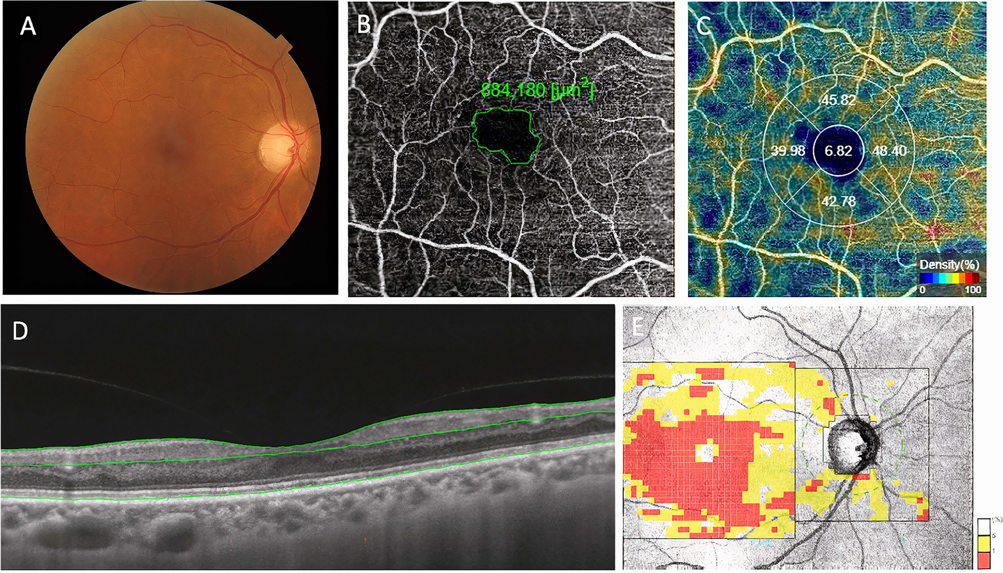 Fig. 1