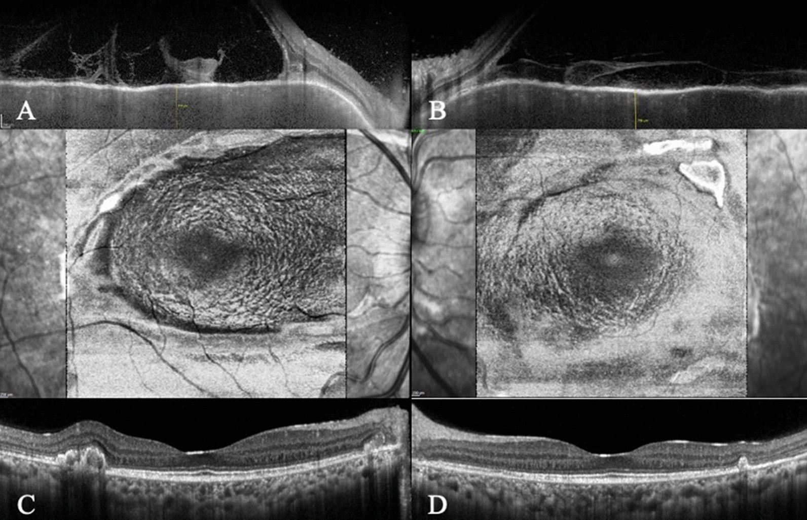 Fig. 2