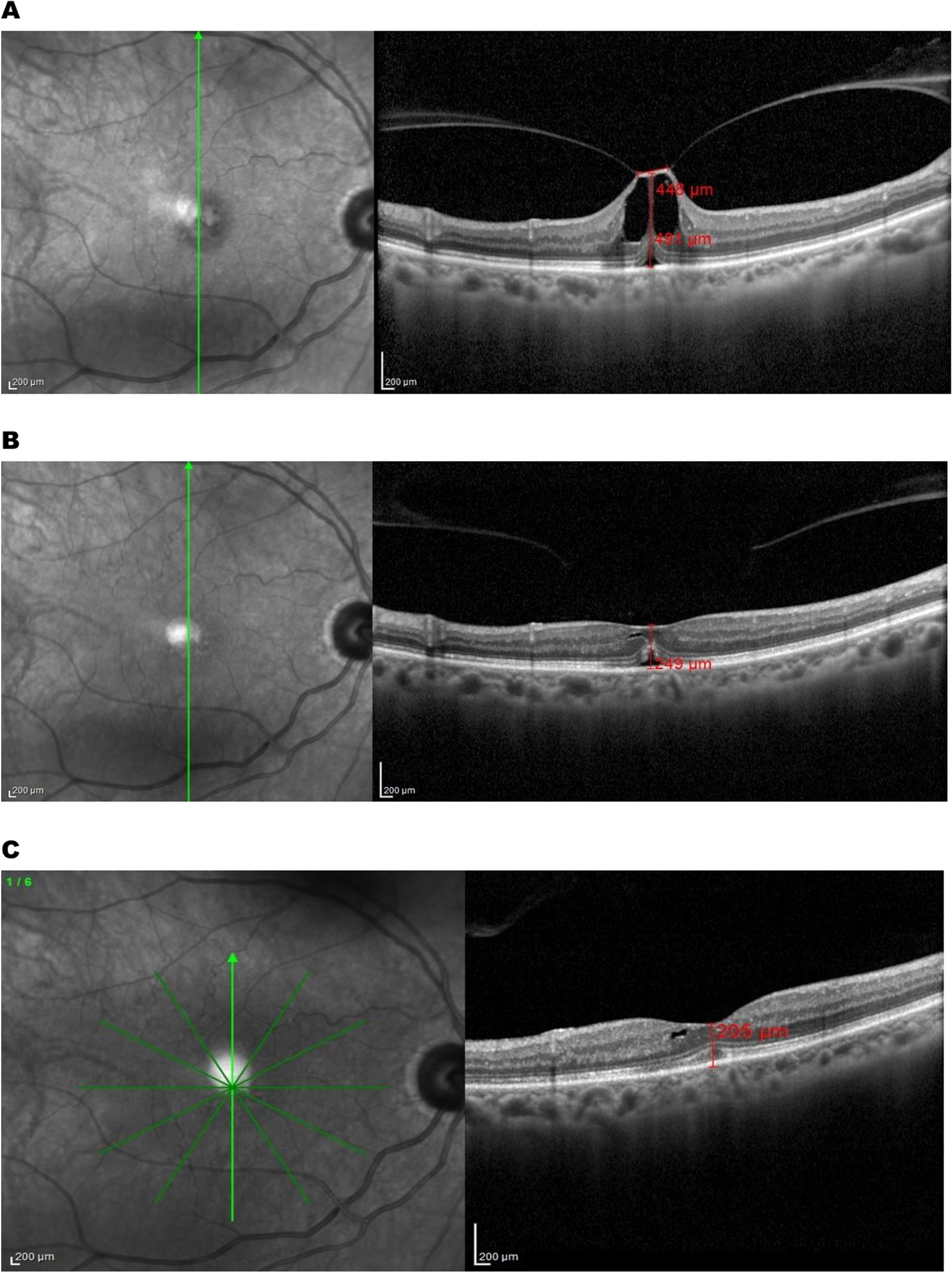 Fig. 5