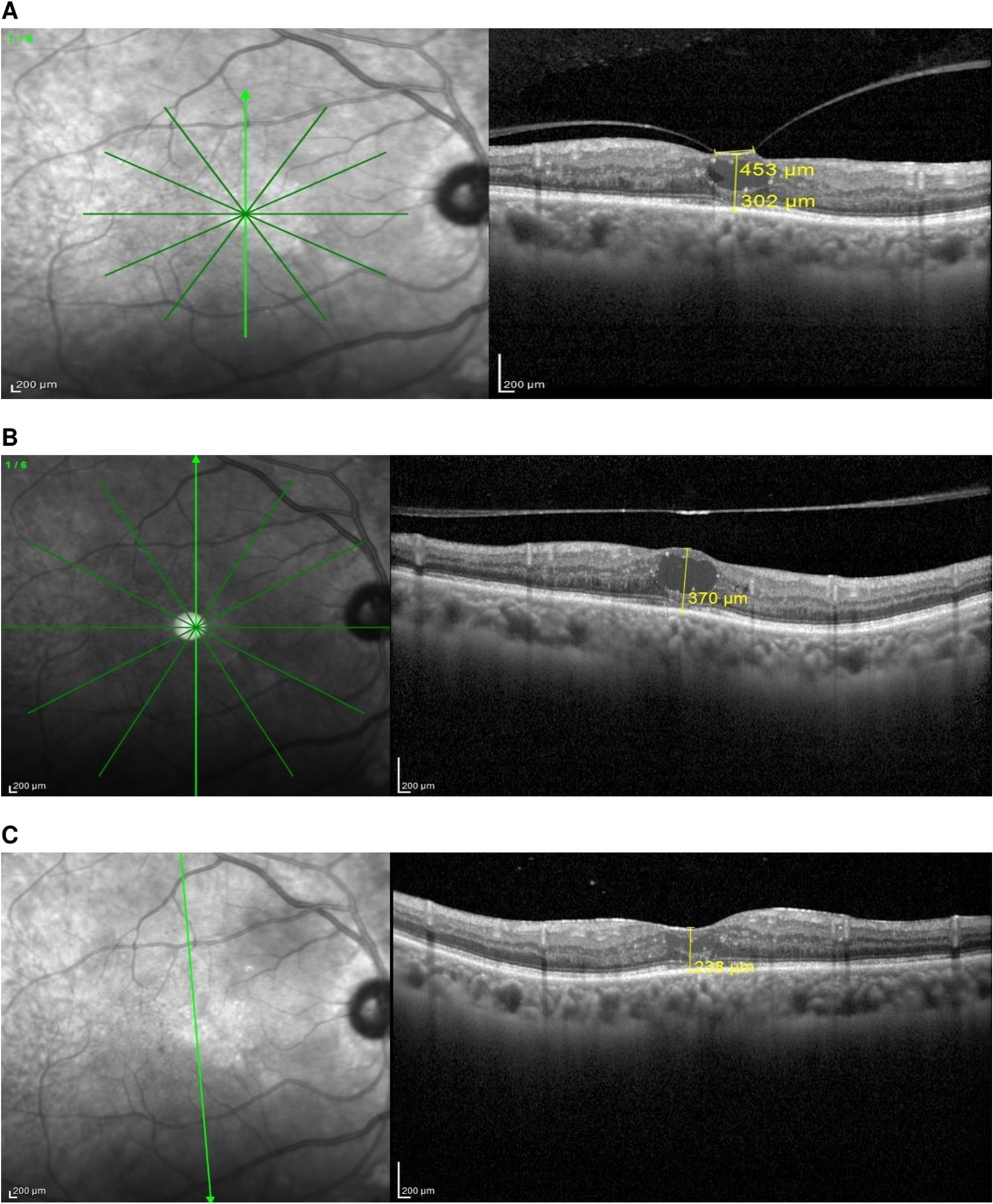 Fig. 6