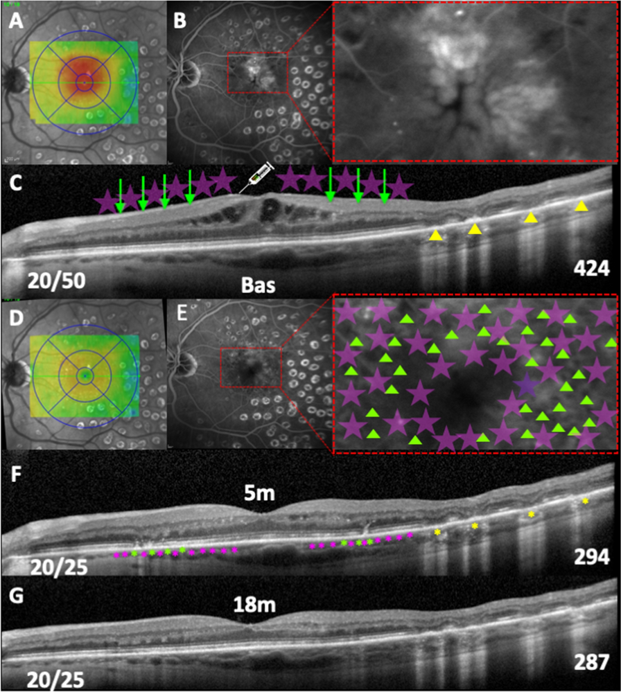 Fig. 4