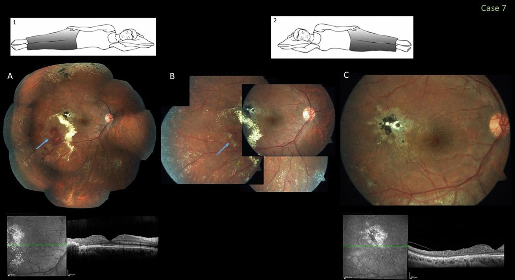 Fig. 7