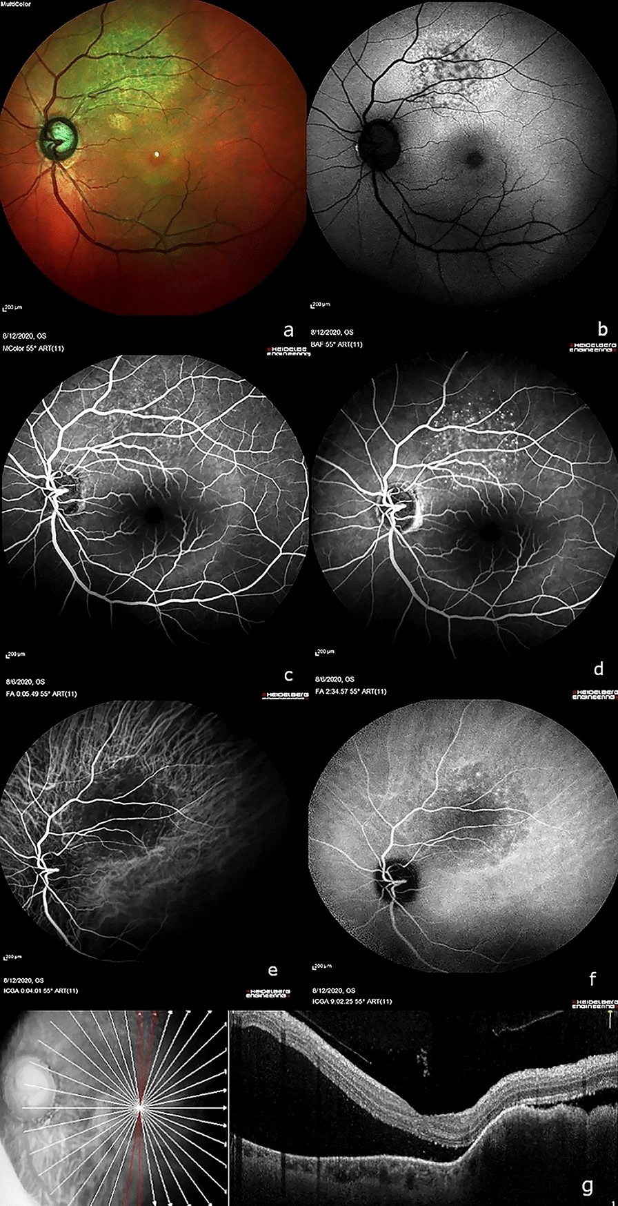 Fig. 1