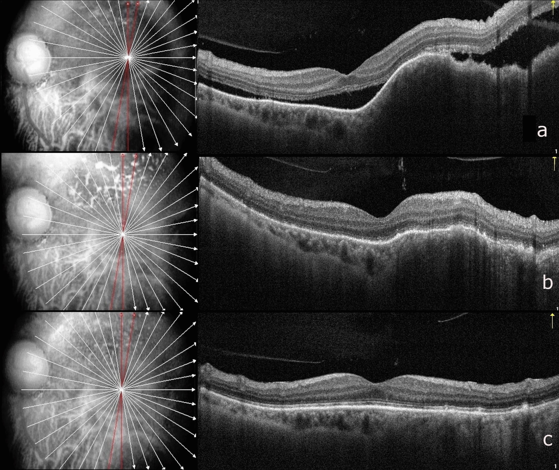 Fig. 3