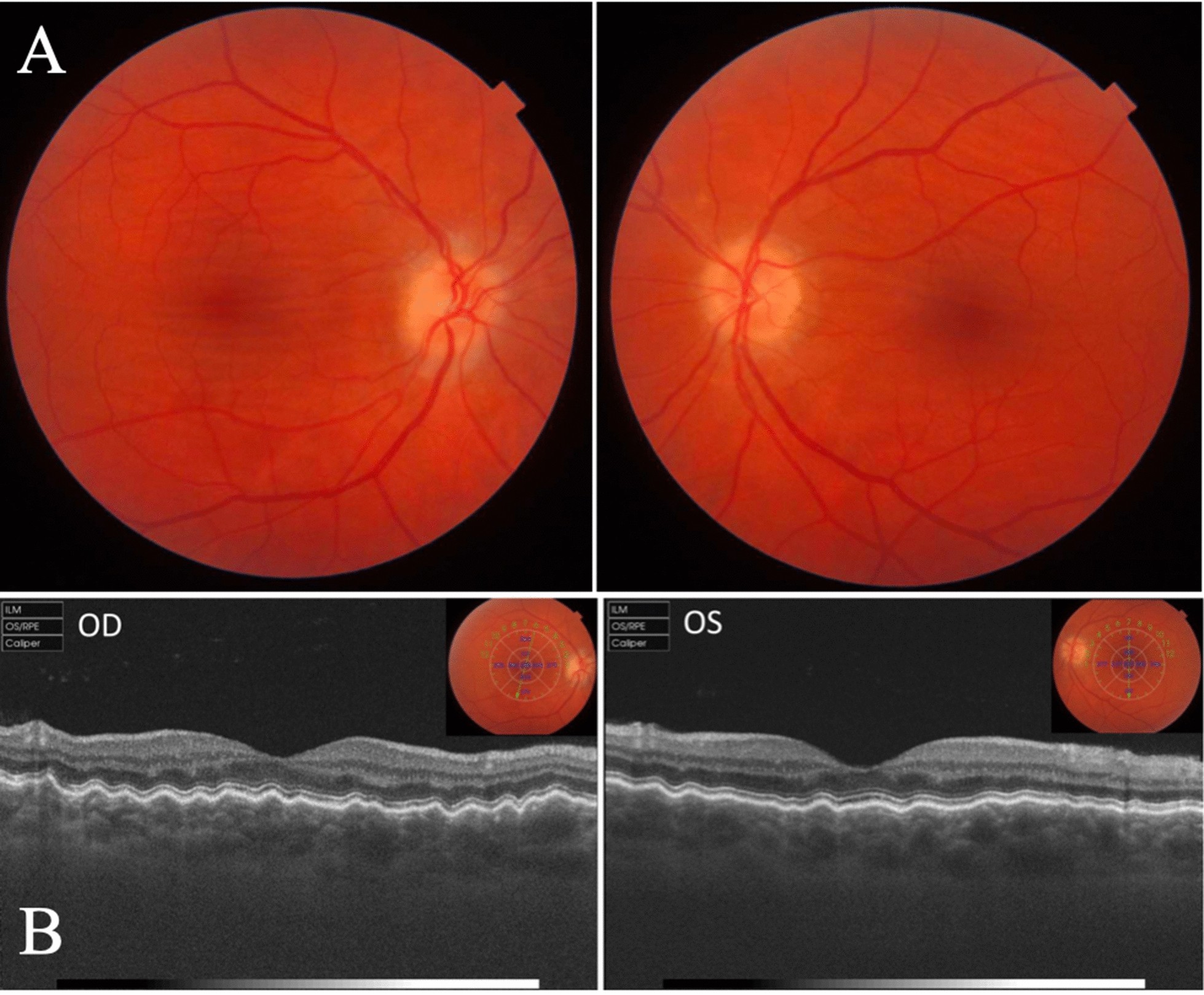 Fig.1