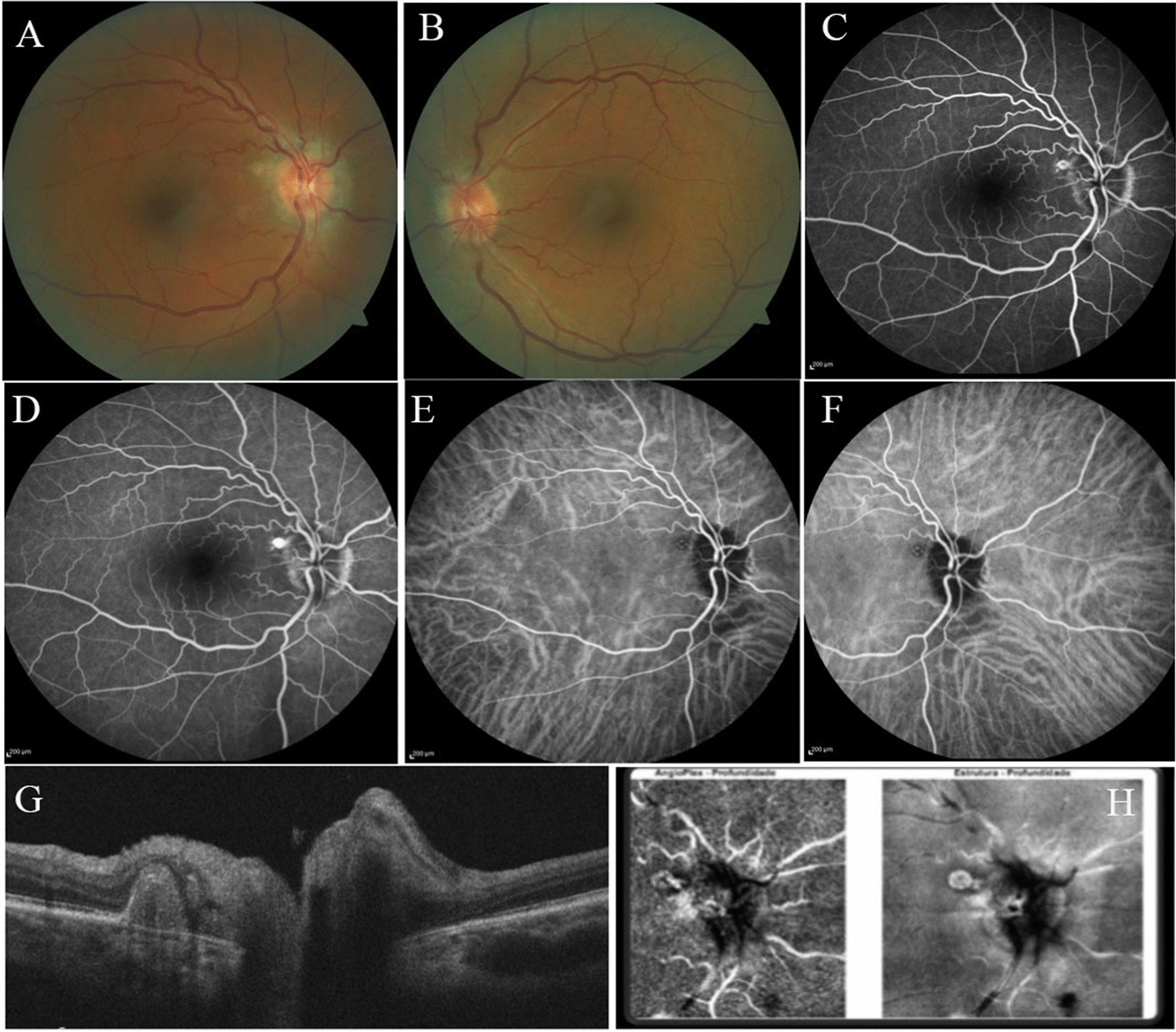 Fig.2