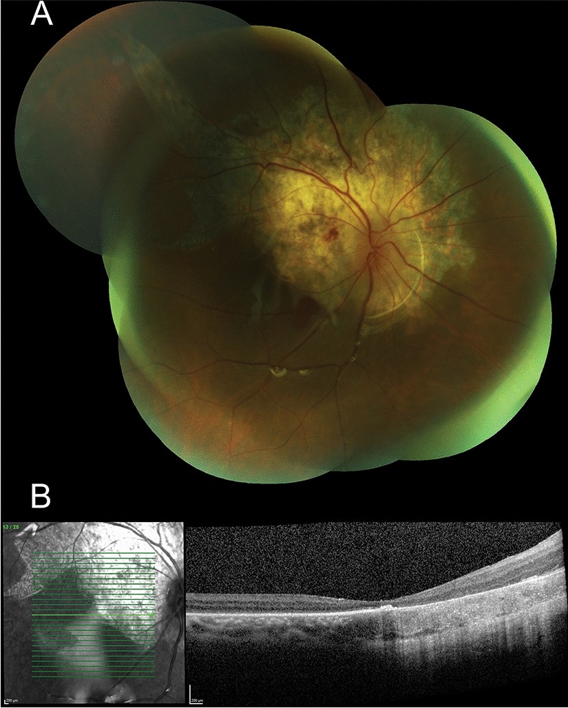 Fig. 4