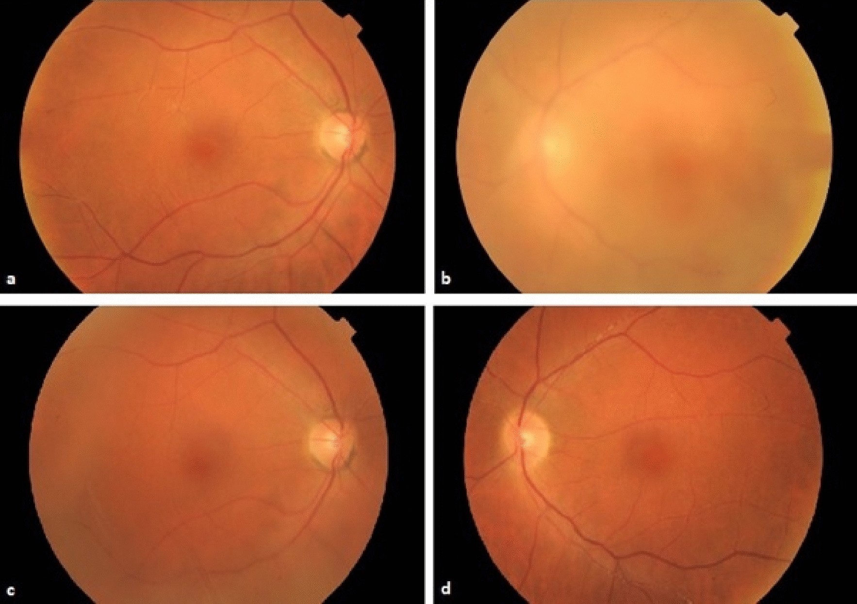 Fig. 1