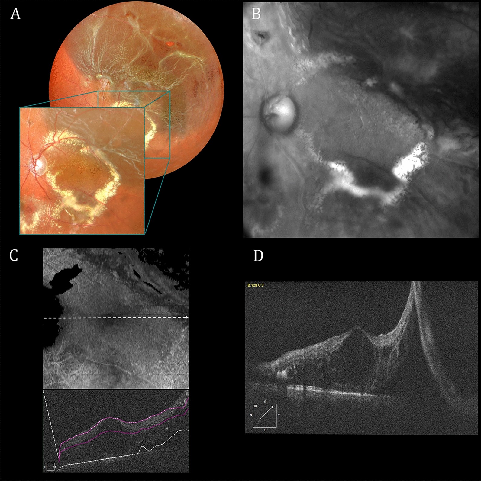 Fig. 4