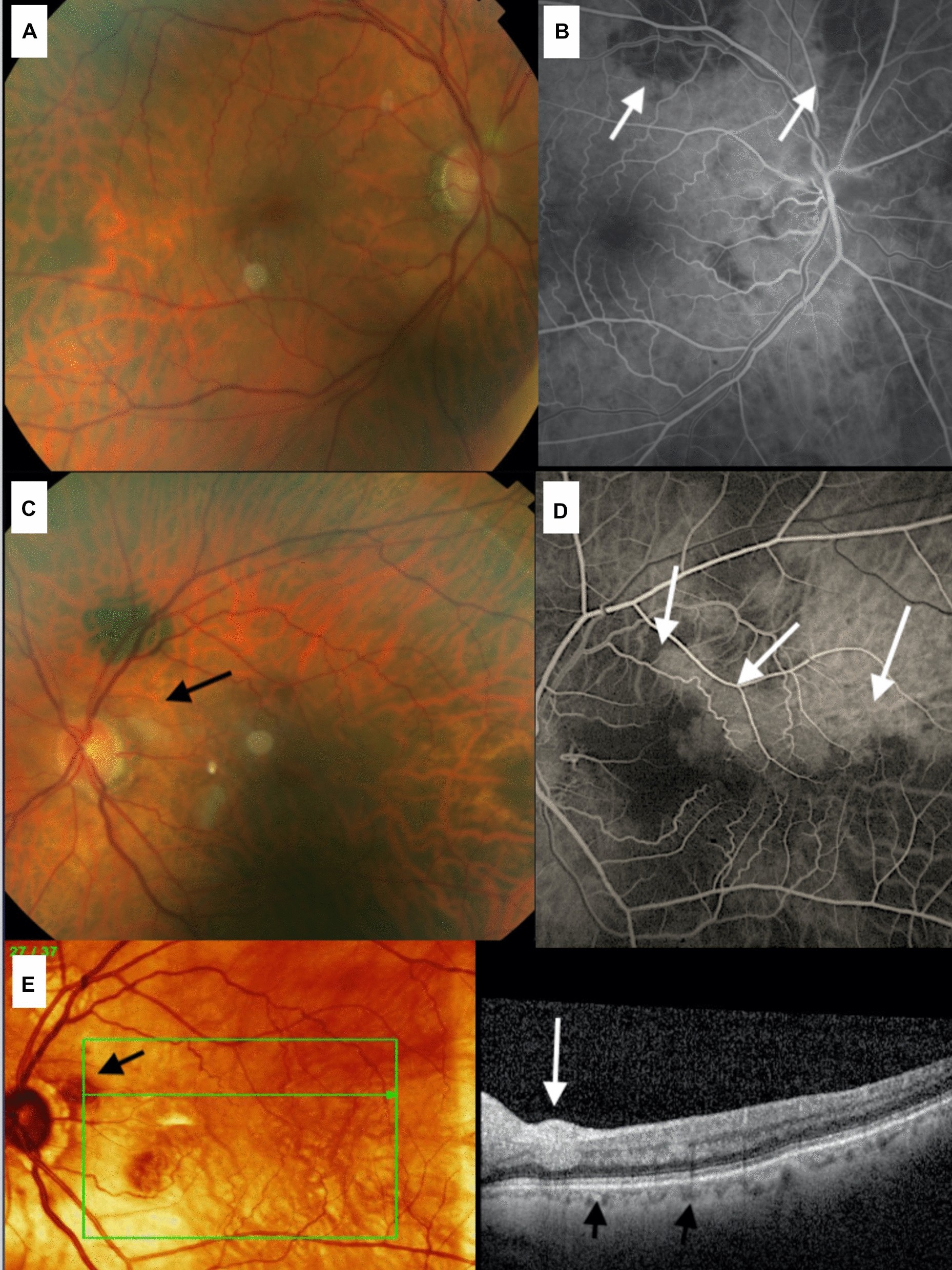 Fig.3