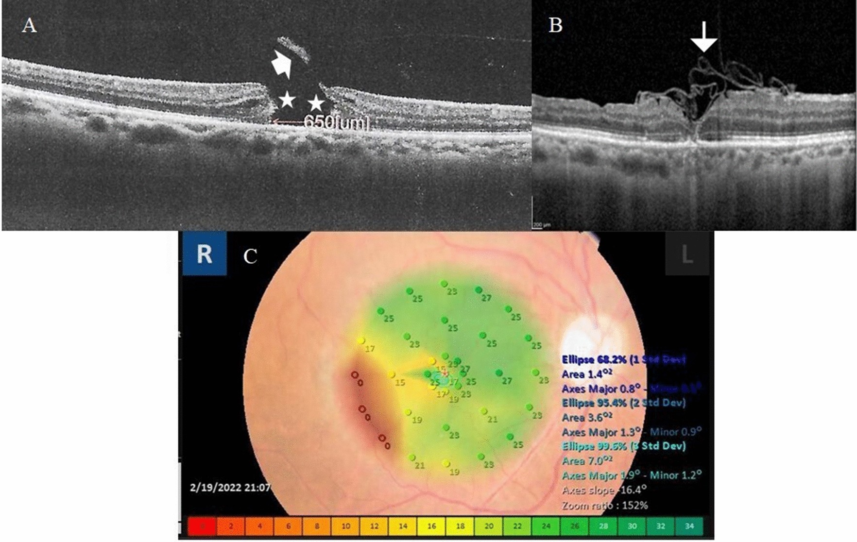 Fig. 4