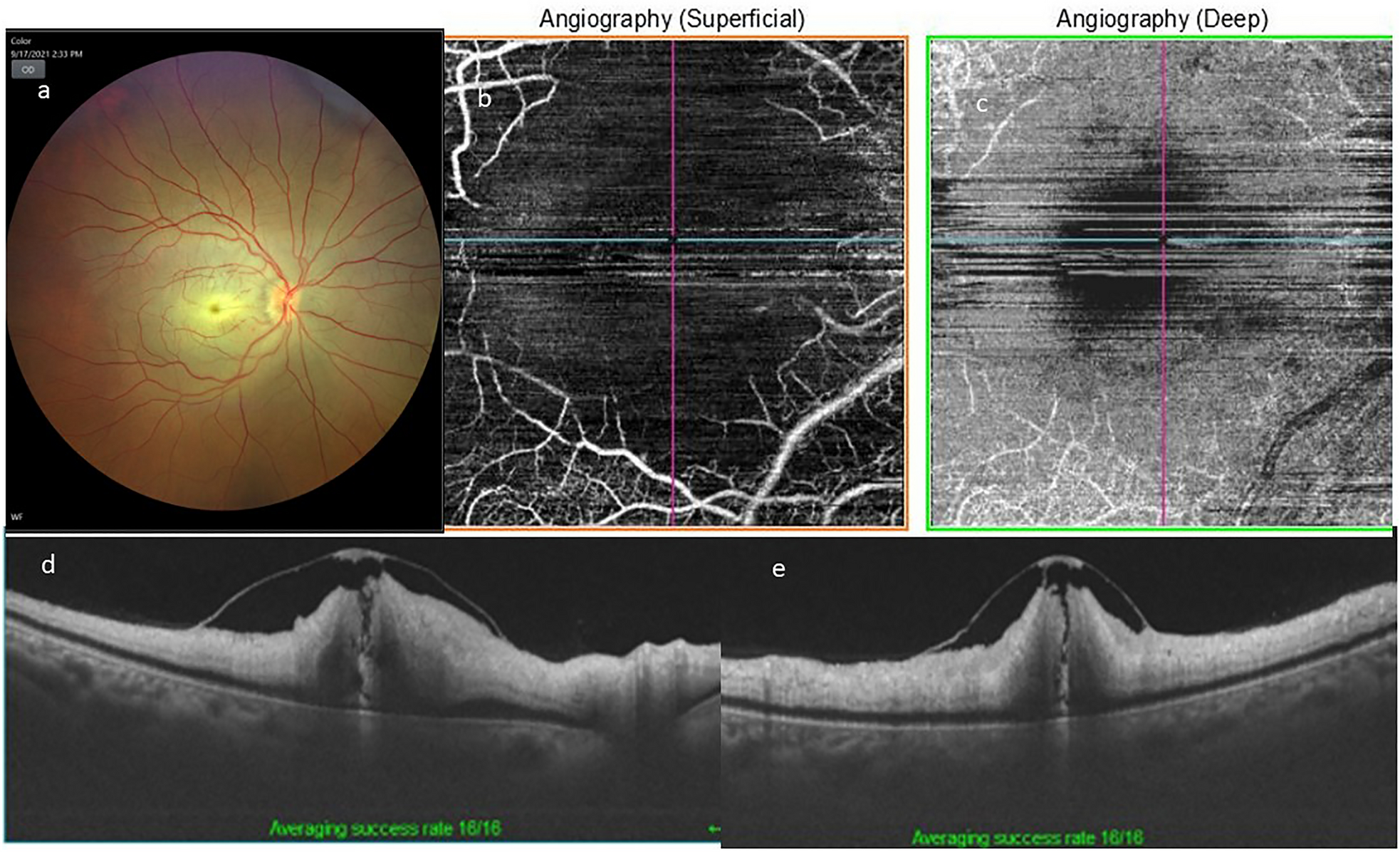 Fig. 2