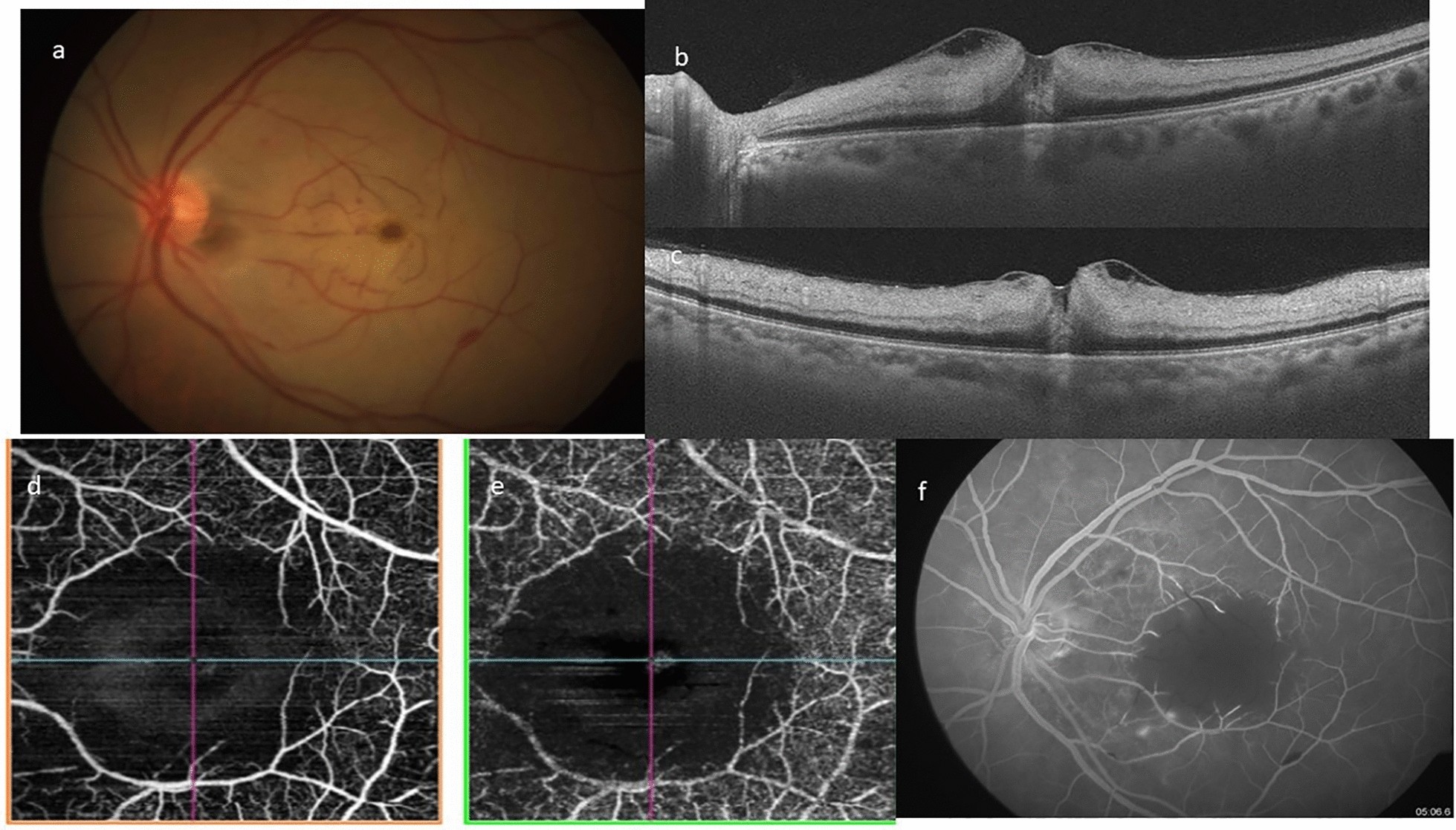 Fig. 3