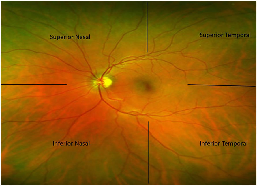 Fig. 1