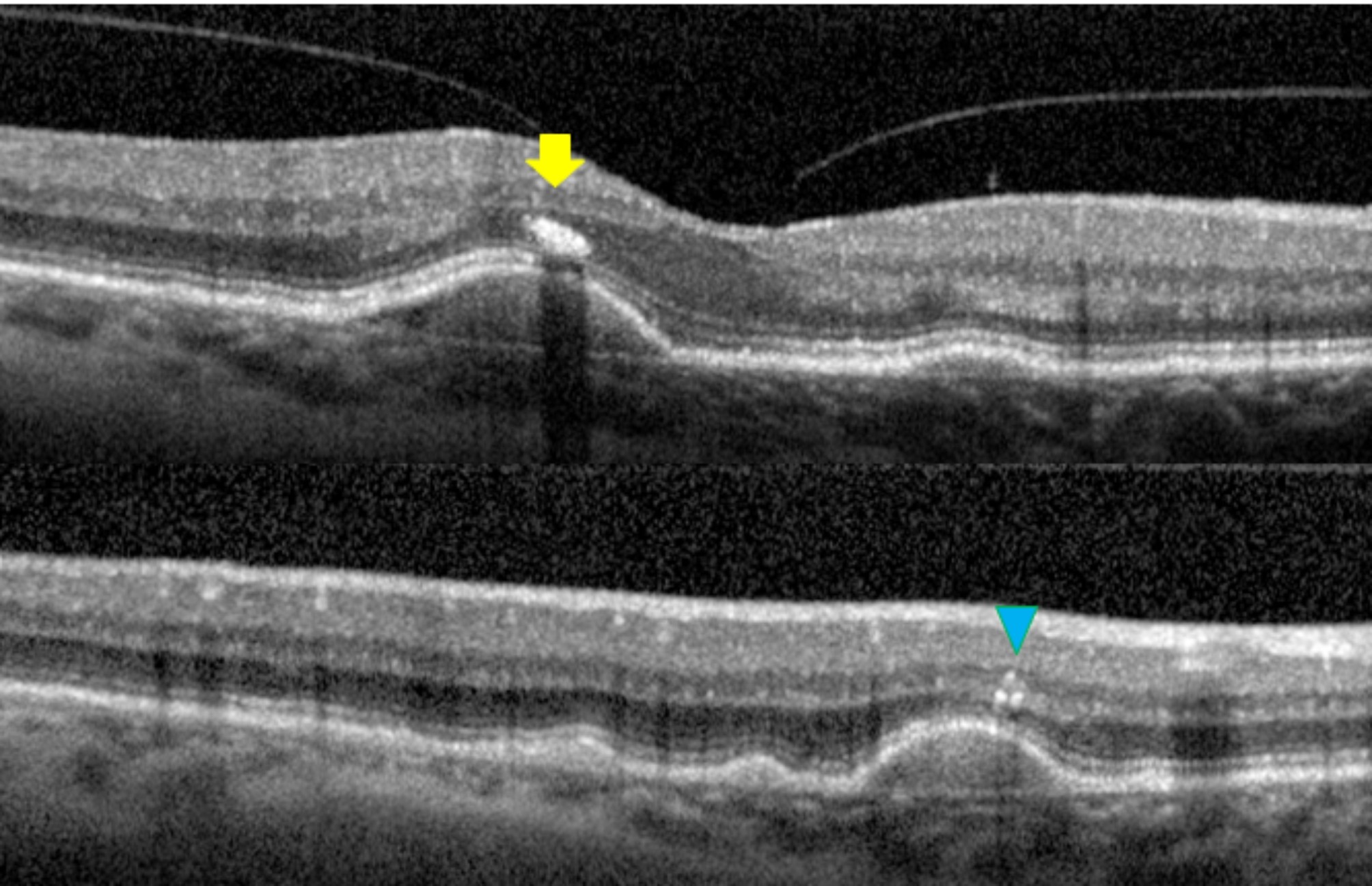 Fig. 3