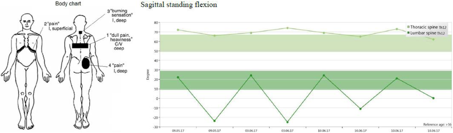 Fig. 1 (abstract P29).