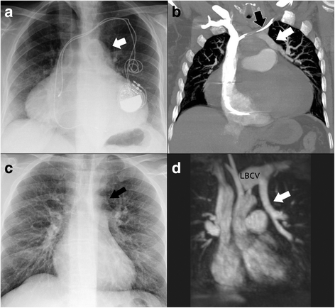 Fig. 11