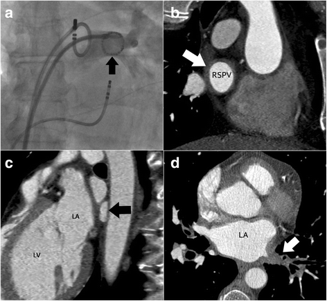 Fig. 14