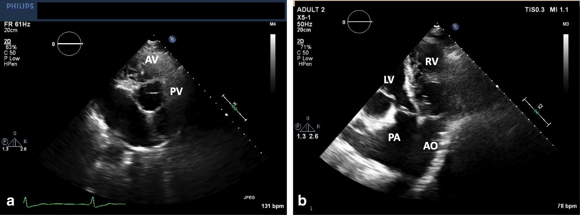 Fig. 4