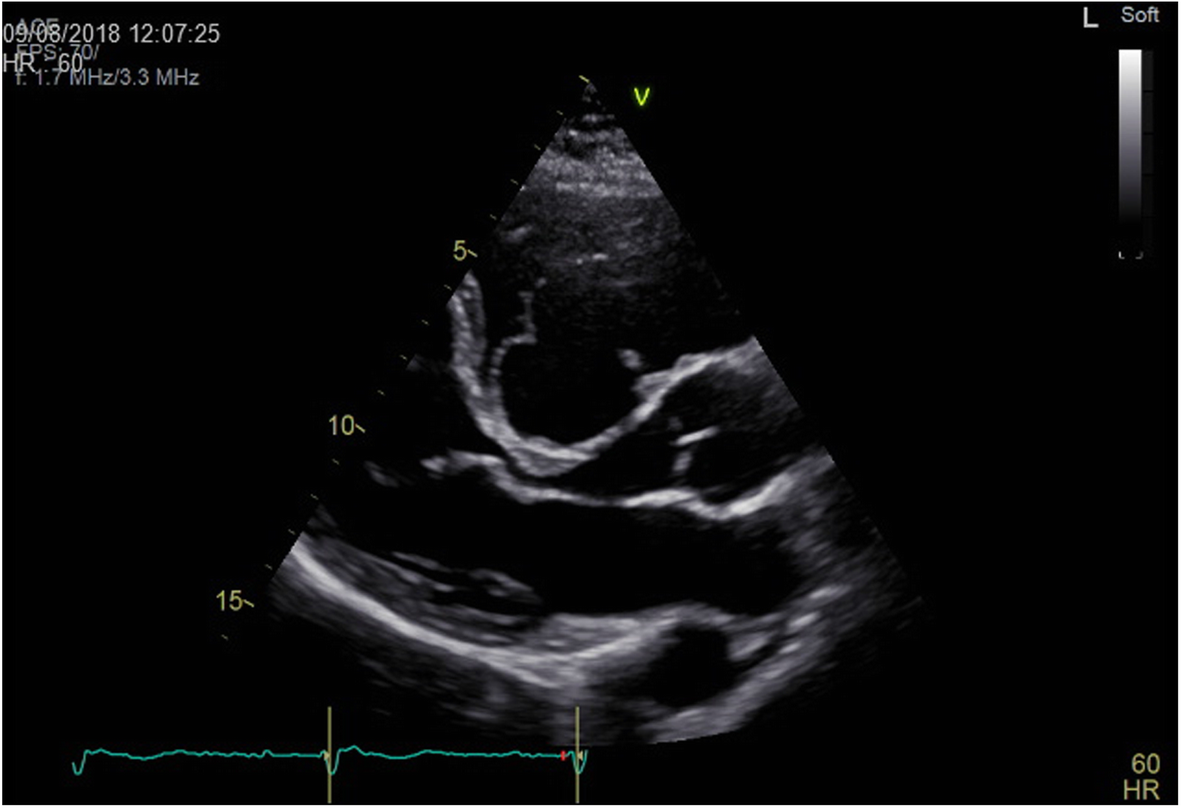 Fig. 2