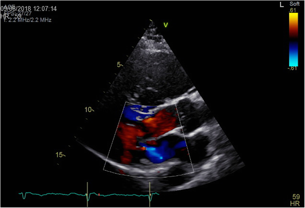 Fig. 4