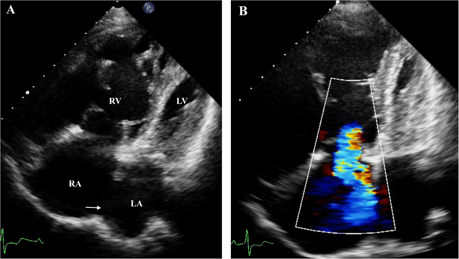 Fig. 2