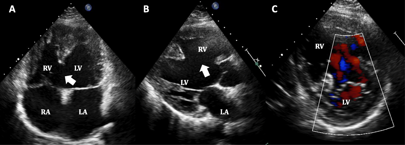 Fig. 4