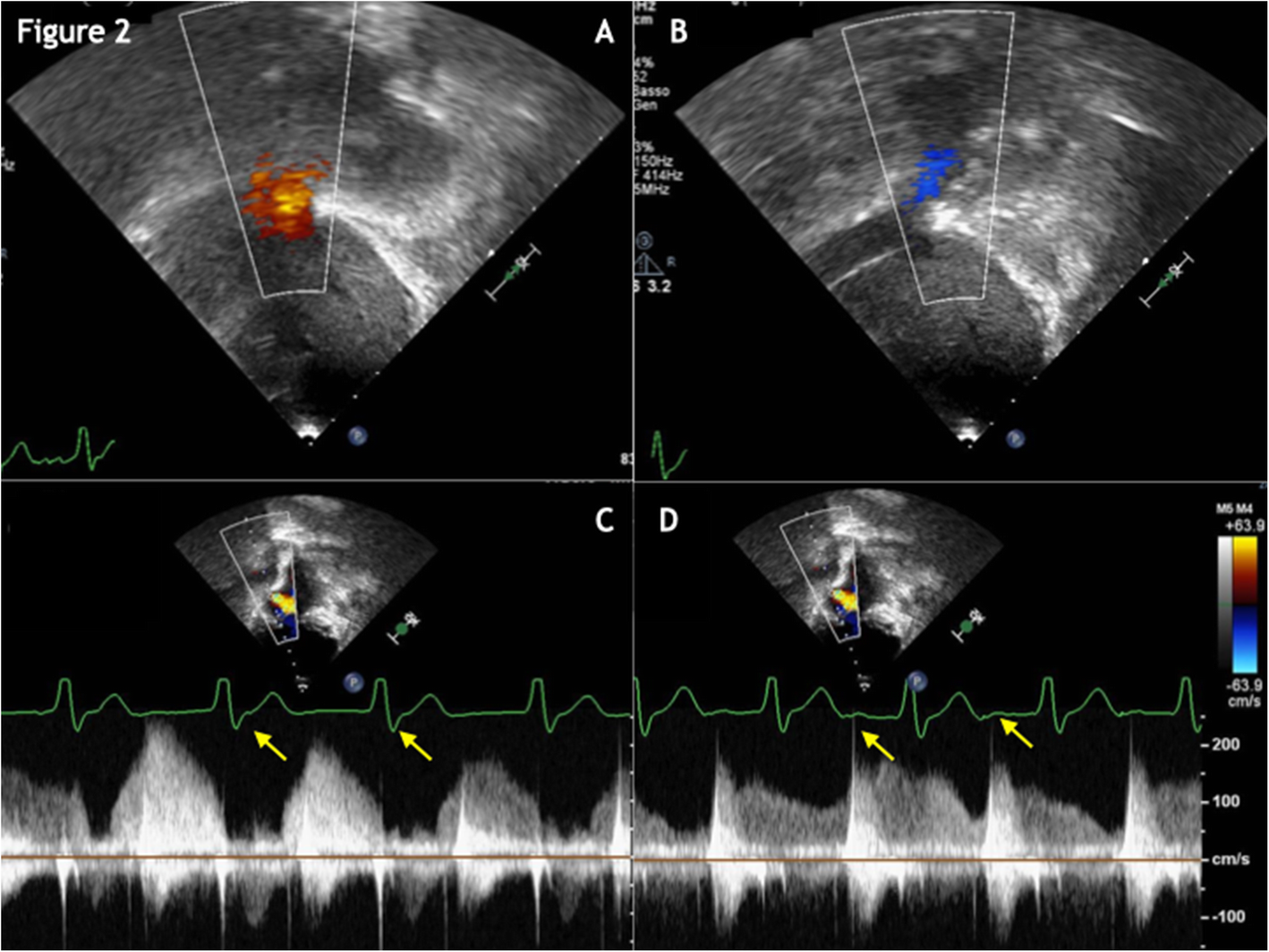 Fig. 2