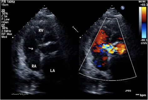 Fig. 2