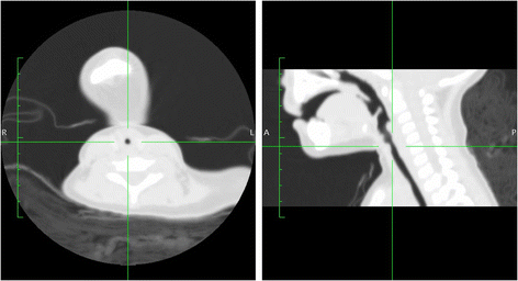 Fig. 3