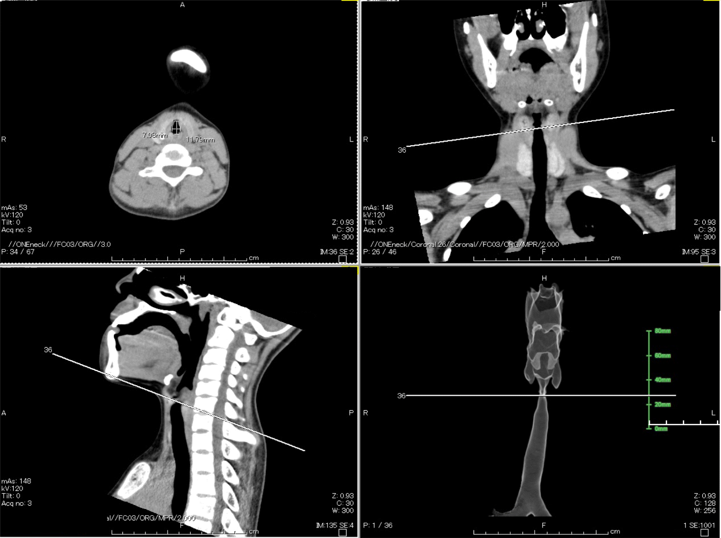 Fig. 2