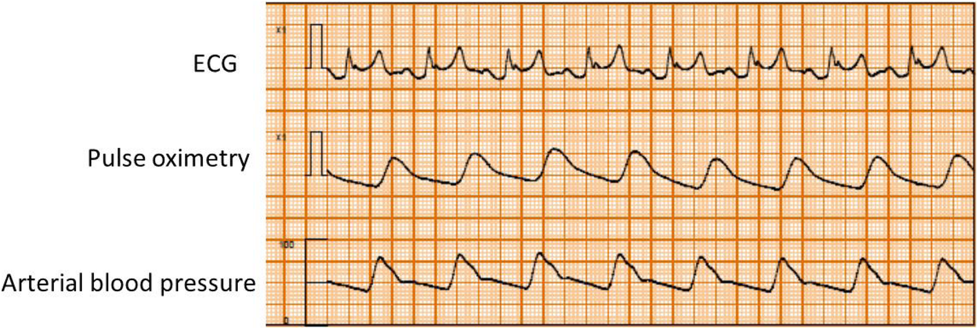 Fig. 3