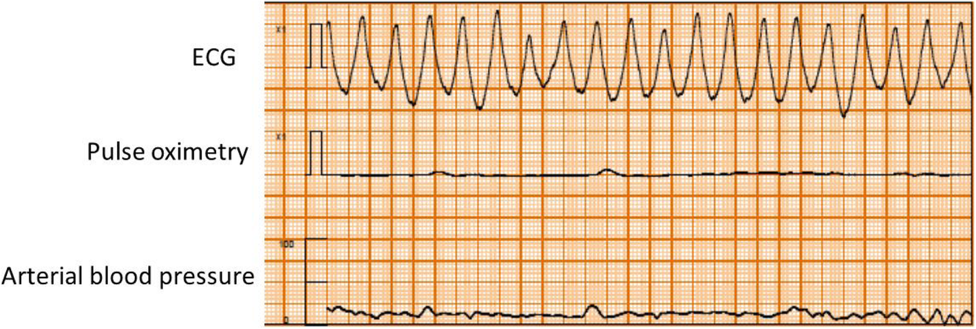 Fig. 4