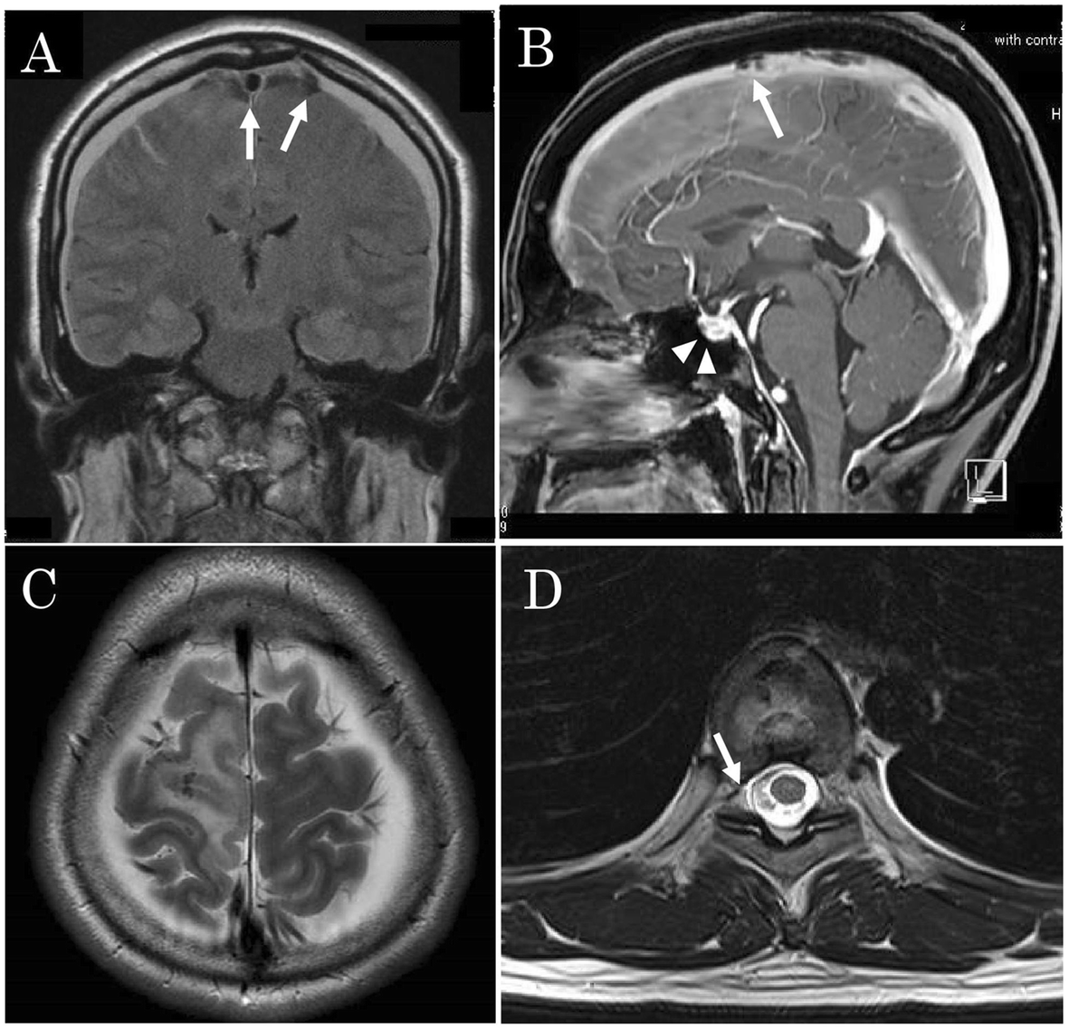 Fig. 2