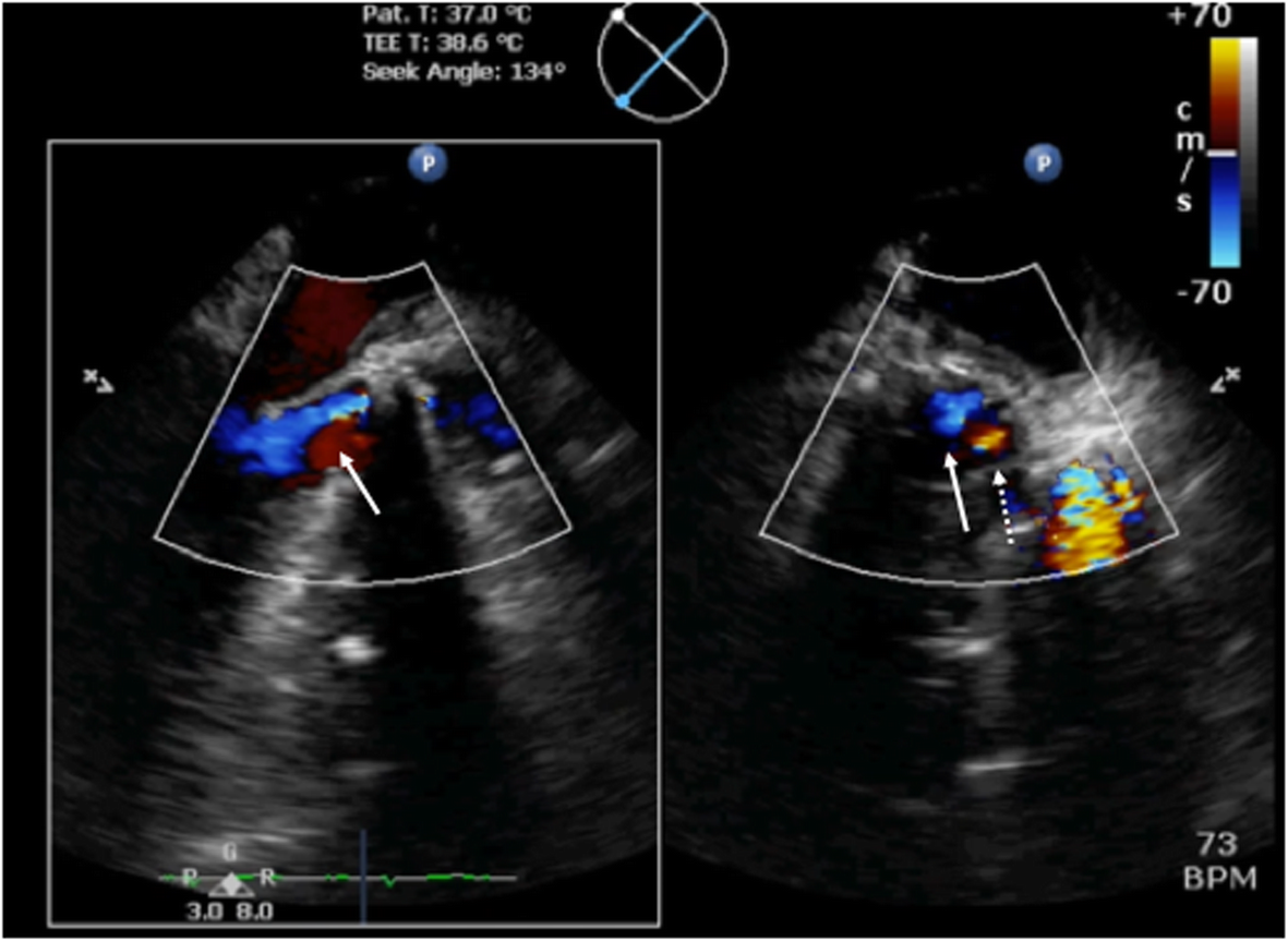 Fig. 2